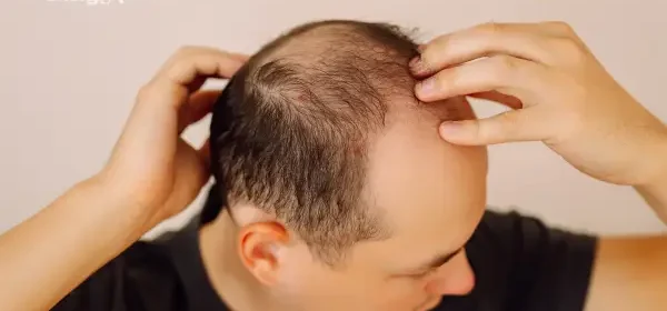 ways to improve hair health naturally